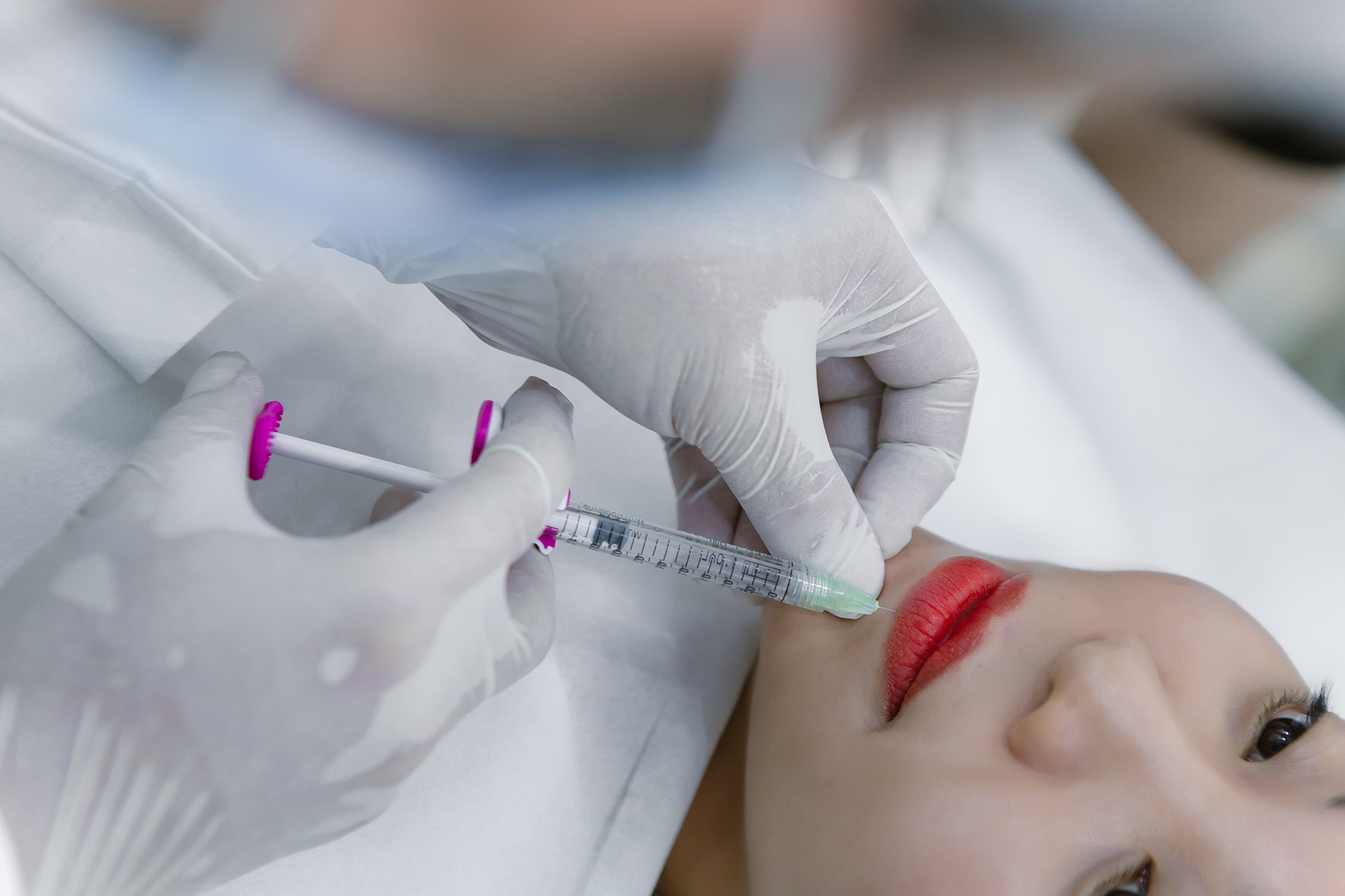 Tiêm Filler Long Thành