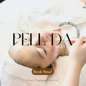 Dịch vụ Peel da mụn tại quận 2