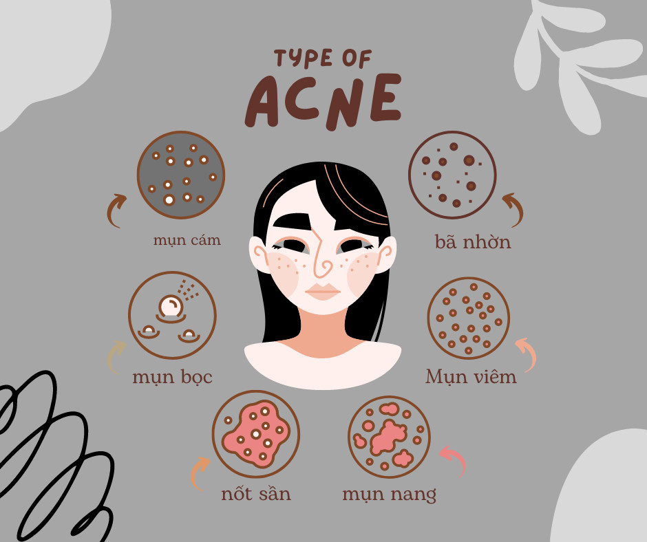 Spa điều trị mụn khoa học nhất Quận 2, tp HCM