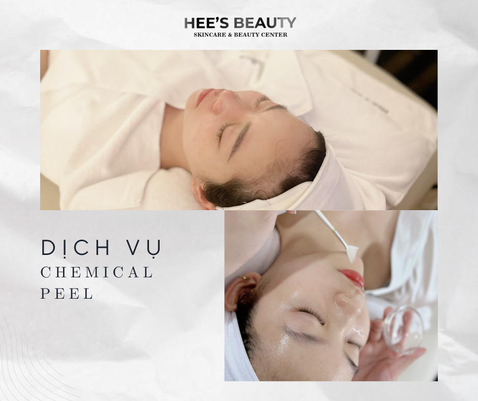 Dịch vụ chemical peel