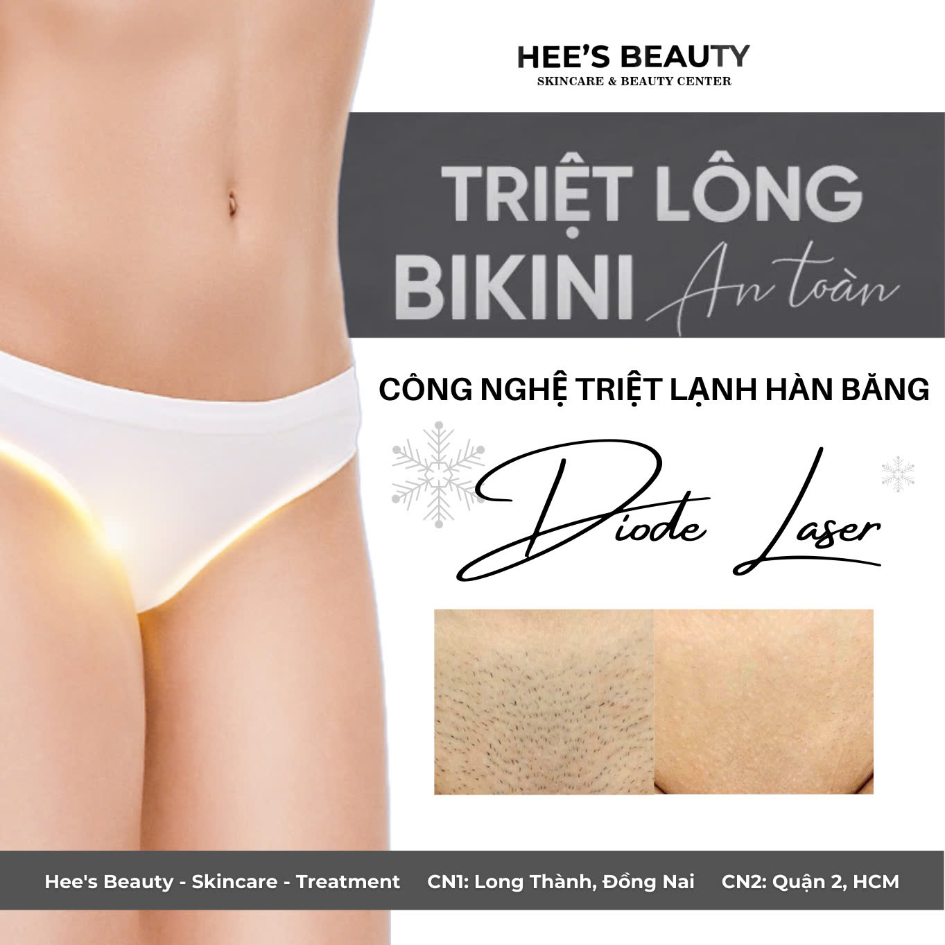 TRIỆT LÔNG: ĐỊA CHỈ UY TÍN QUẬN 2 